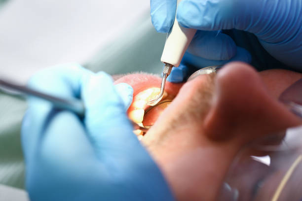 Urgent Tooth Repair in IN