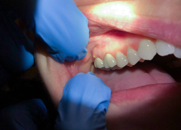 Best Broken Tooth Emergency  in Fairview Park, IN