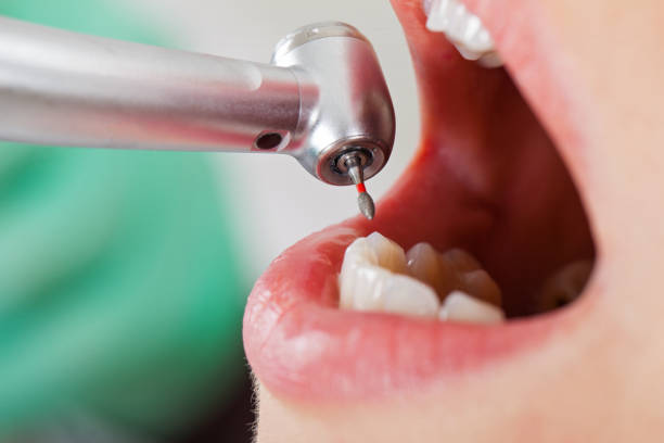 Best Dentist for Tooth Abscess  in Fairview Park, IN
